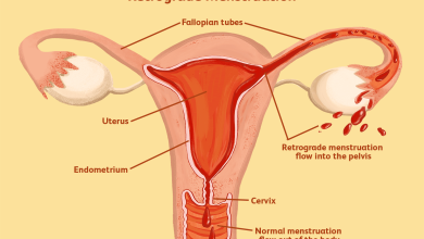 Photo of What are abnormal periods?