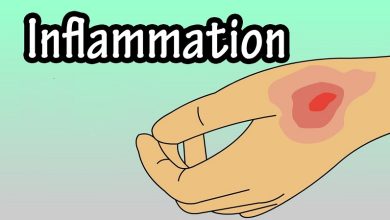 Photo of Inflammation – Is It Really Bad? Myths Dispelled