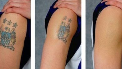 Photo of Embarking on a New Journey: Understanding the Process of Professional Tattoo Removal